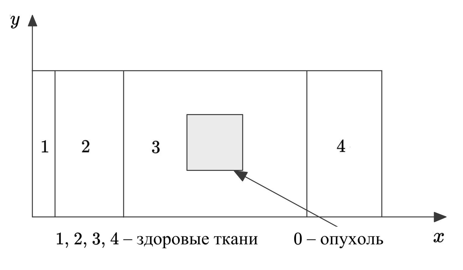 Численное моделирование высокоинтенсивной фокусированной ультразвуковой терапии (HIFU) при лечении рака молочной железы
